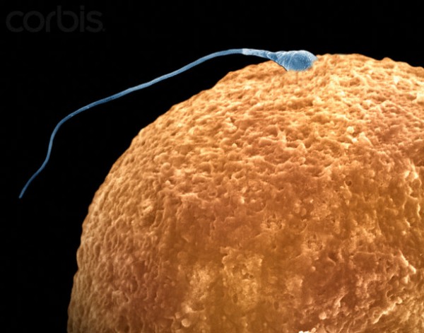 Human sperm